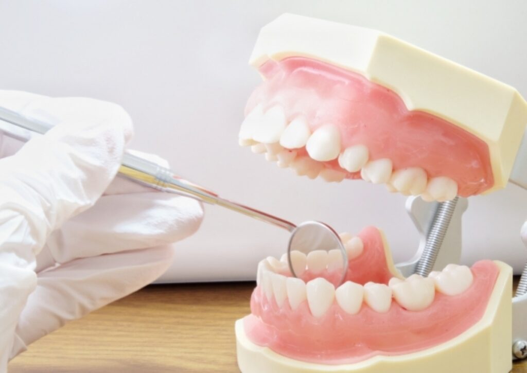 歯周病が悪化するとどうなる？